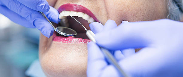 Best Emergency Dental Care for Sports Injuries in Belmont, CA